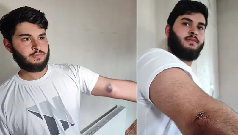 Bahçeye Kaçan Top, Mahallede Heyecan Dolu Anlar Yarattı!